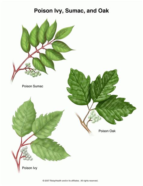 Poison Ivy Oak Sumac Causes Symptoms Treatment Poison Ivy Oak