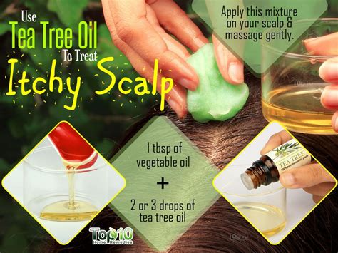 How To Get Rid Of Itchy Scalp Home Remedy