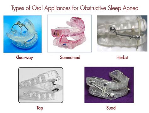 Sleep Apnea Smile Design And Beyond Los Angeles Orthodontist