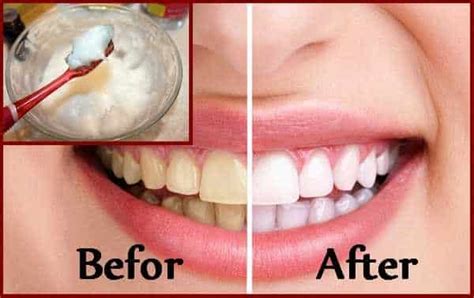 Brushing Teeth With Baking Soda 5 Safety Tips Home Remedies