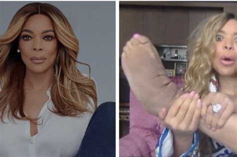 wendy williams reveals how large her feet are due to lymphedema [watch]