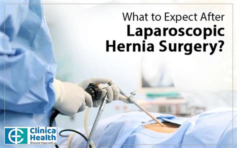 What To Expect After Laparoscopic Hernia Surgery