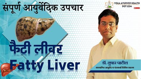 Fatty Liver Ayurvedic Treatment फैटी लीवर संपूर्ण आयुर्वेदिक उपचार