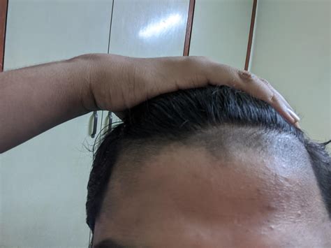 My Barber Messed Up Any Tips For Growing It Faster Or Any Hairstyle That I Can Try To Cover It