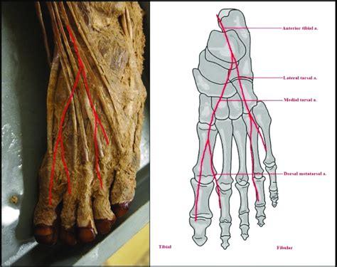 Dorsalis Pedis Artery Anatomy