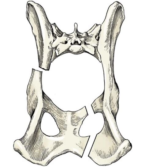 Dog anatomy details the various structures of canines (e.g. Fractures of the Pelvis | Veterian Key
