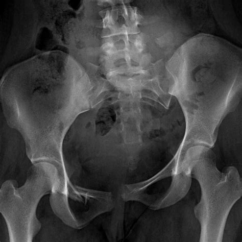 interactive pelvis and hip radiograph cases
