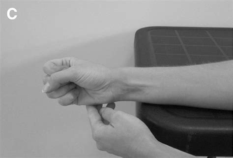 Related online courses on physioplus. De Quervain's Tenosynovitis - Causes, Symptoms, Test ...