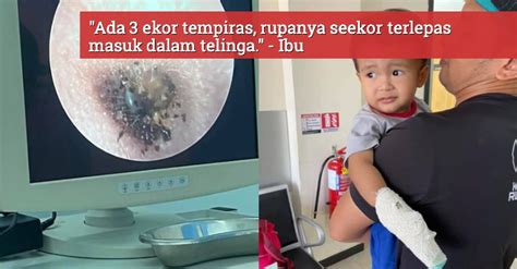 We did not find results for: Ibu Trauma, Telinga Anak Sakit Rupanya Tempiras 'Tumpang ...