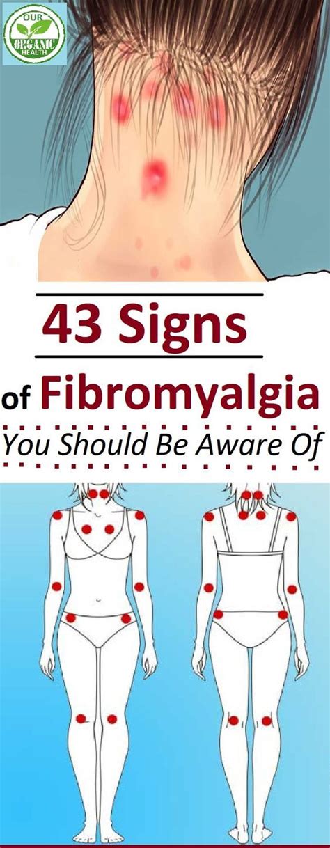 Signs Of Fibromyalgia You Should Be Aware Of Signs Of Fibromyalgia
