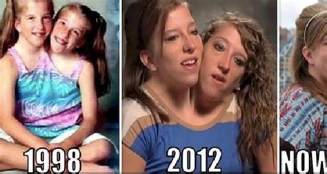 interesting things about famous conjoined twins abby and brittany hensel with images