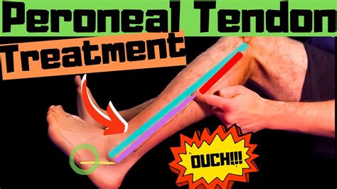 Peroneal Tendonitis Self Treatment Stretches Exercises Massage YouTube