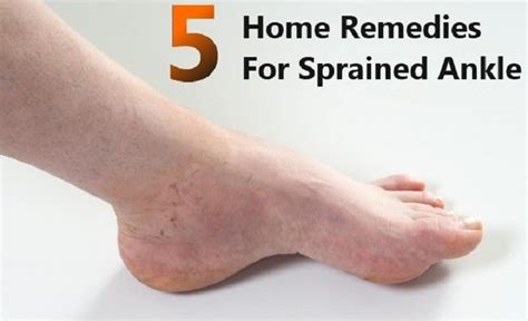 Best Home Remedies For A Sprained Ankle Top 5 Home Remedies