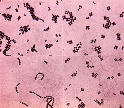 Streptococcus Gram Stain