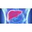 Does Hepatitis B Treatment Lower The Risk Of Liver Cancer  Health