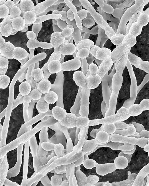 Mould Cladosporium Sp Hyphae And Spores Sem Stock Image C037