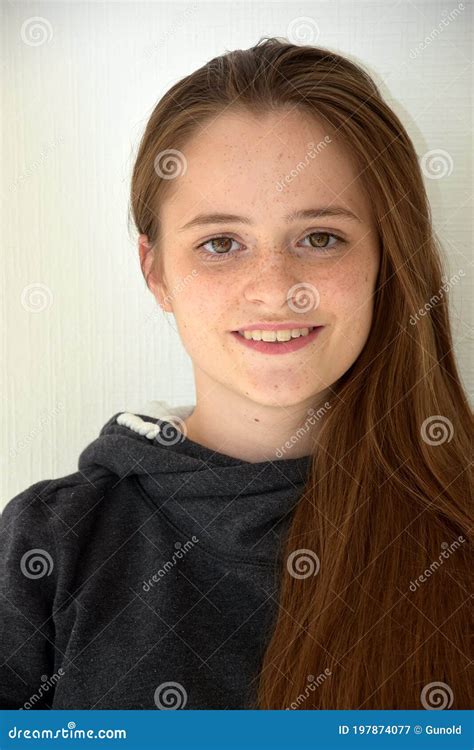 Teens With Freckles Telegraph