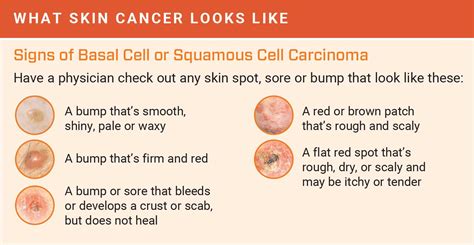 How To Test For Skin Cancer On Scalp