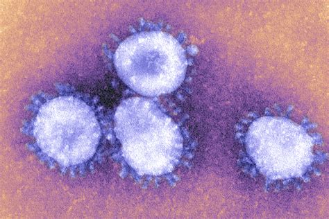 Coronavirus Variants What They Do And How Worried You Should Be Ars