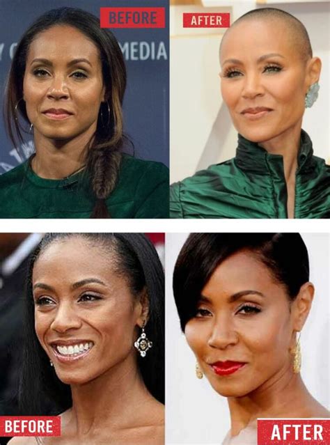 Did Jada Pinkett Has Undergone Plastic Surgery Her Before And After