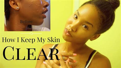How To Get Clear Glowing Skin Youtube