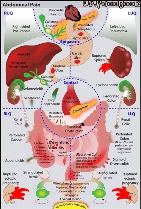Abdominal Pain By Location Right Upper Quadrant The