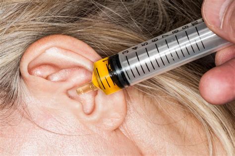 Why Does My Ear Feel Clogged Home Remedies For Wax And More