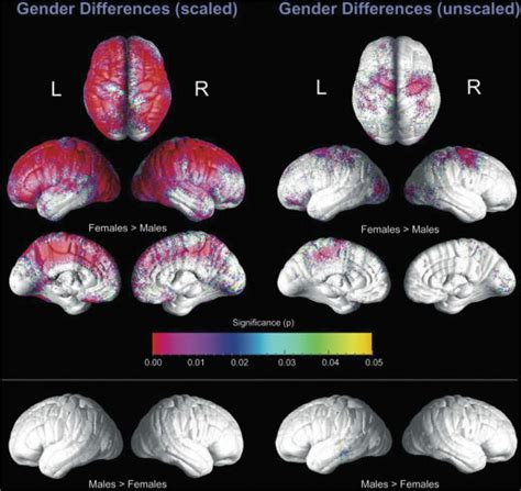 Sex On The Brain Are Gender‐dependent Structural And Functional Differences Associated With