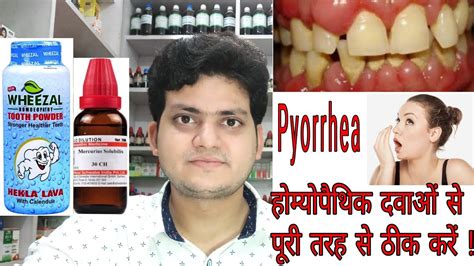 Periodontal Treatment Homeopathic Bruin Blog