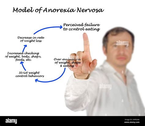 Model Of Development Of Anorexia Nervosa Stock Photo Alamy