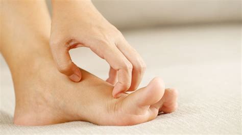 How To Stop Itchy Feet Causes Of Itchy Feet And Treatment