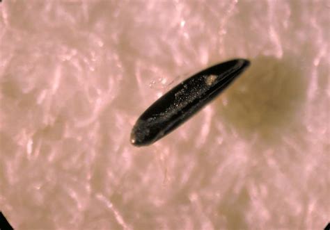 Pentingnya penangan demam ini, agar komplikasi tidak terjadi. Obrázek - Aedes aegypti (komár tropický) | BioLib.cz