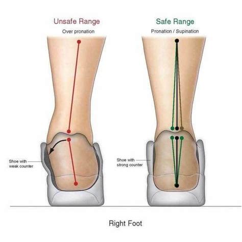 This is where the vast majority of you will fall under. Flat Feet Overpronation Causes, Treatment and Prevention ...