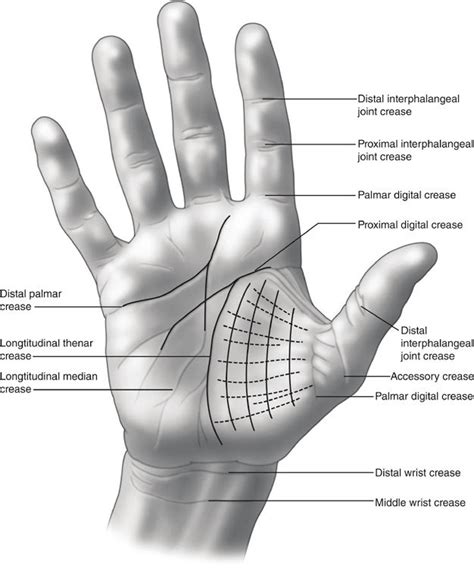 1 Palmar Creases Of The Hand And Wrist Download Scientific Diagram