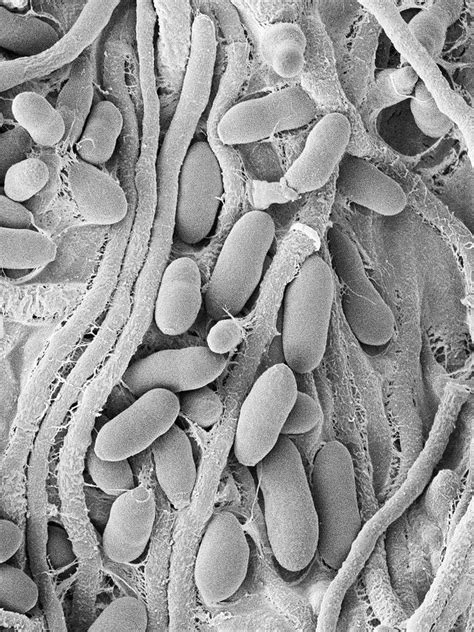 Fungus Acremonium Stromaticum Photograph By Dennis Kunkel Microscopy