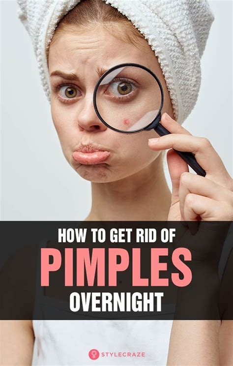 How To Get Rid Of Pimples Overnight Fast Pimples Overnight How To