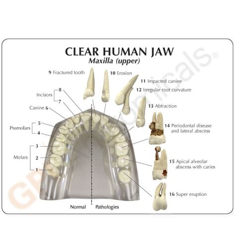Human Teeth And Jaw Anatomy Model Clinical Charts And Supplies