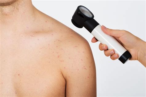 What Is A Full Body Skin Exam Hk Dermatology Dermatology Clinic
