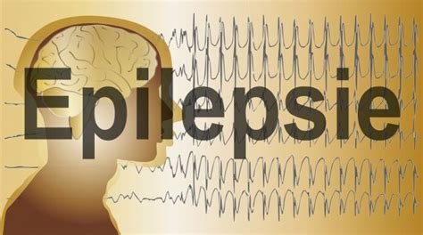Epilepsie Anfall Was Tun Captions More