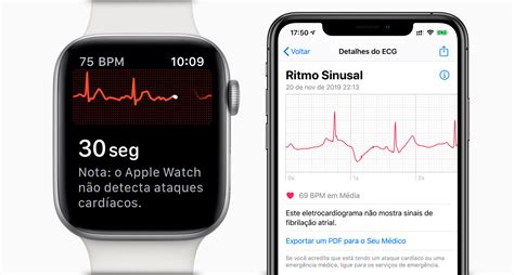 Ecg Apple Watch Malaysia Apple Watch Ecg App A Cardiologists View