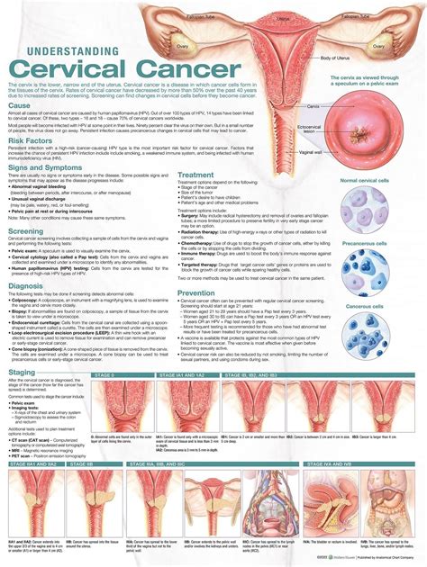 Anatomy Charts Posters Understanding Cervical Cancer Anatomical Chart Edition Second