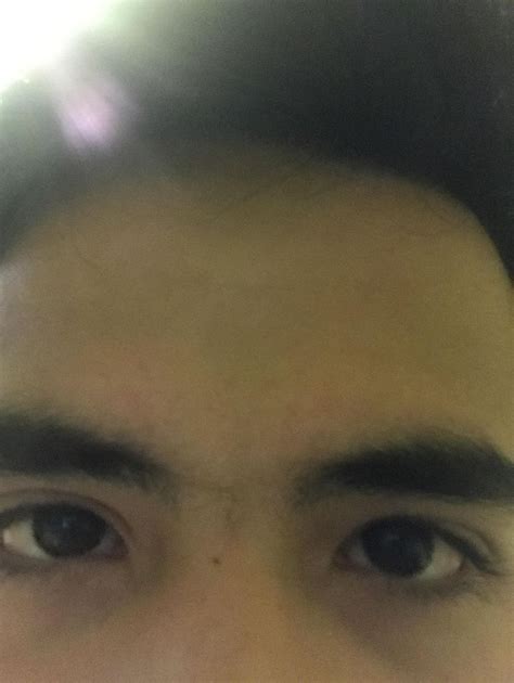 One Of My Eyes Has An Epicanthic Fold Asian The Other Does Not