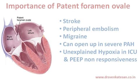 26 Best Patent Foramen Ovale Pfo Images On Pinterest Health