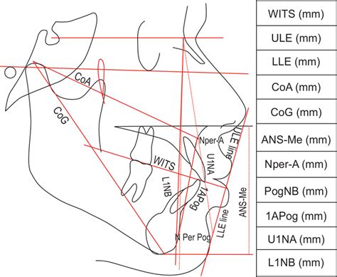 Lateral Cephalometric Tracing With Linear Measurements Download Scientific Diagram