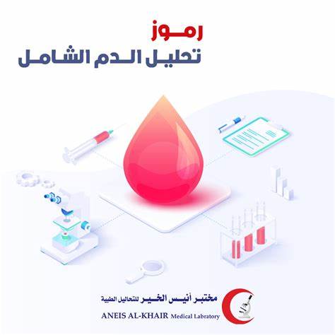 ما هو تحليل الدم الشامل؟