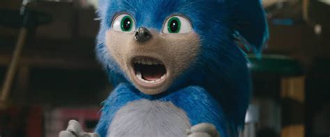 Dentists Explain Why Sonic The Hedgehogs Human Teeth Are Freaking Us Out