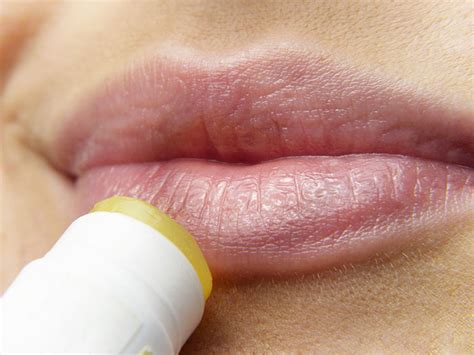 How To Treat Chapped Lips Using Home Remedies