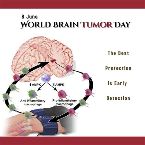 Copy Of World Brain Tumor Day Postermywall