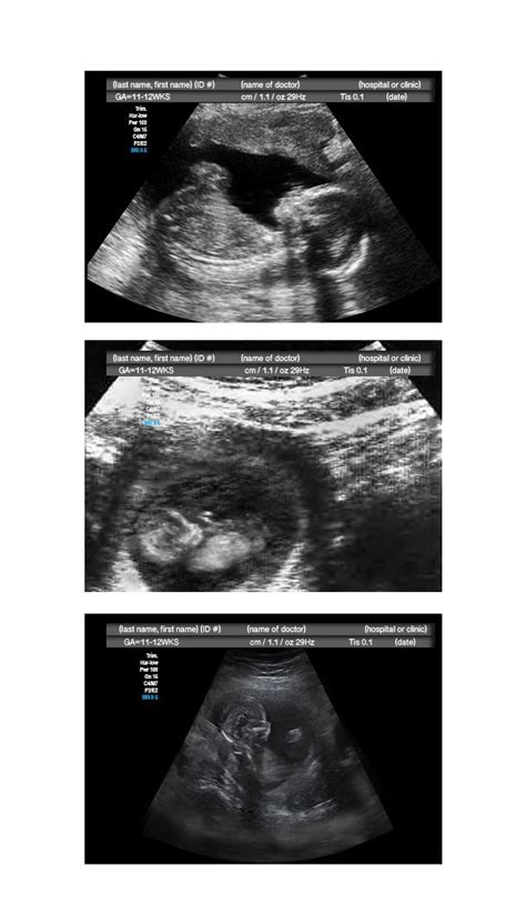 Ultrasound spoof is a fake pregnancy prank mobile app that helps its users to make a fool of family and friends. Buy April Fools Customized PRANK - FAKE Pregnancy PRANK 2D ...