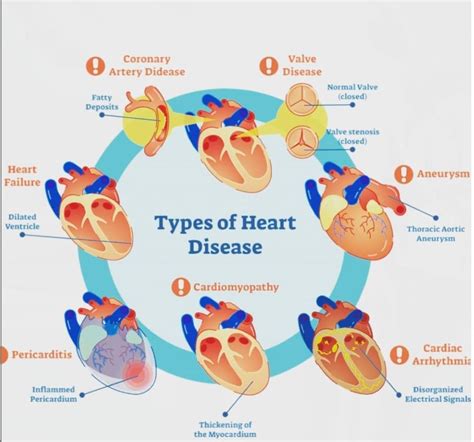 Learn More About Cardiology By Expert Cardiologist Dr Boon Lim Bundle